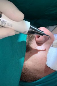 rinoplastia_bisturi_ultrasonico