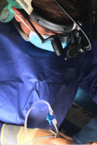 sialoendoscopia_gafas lupa